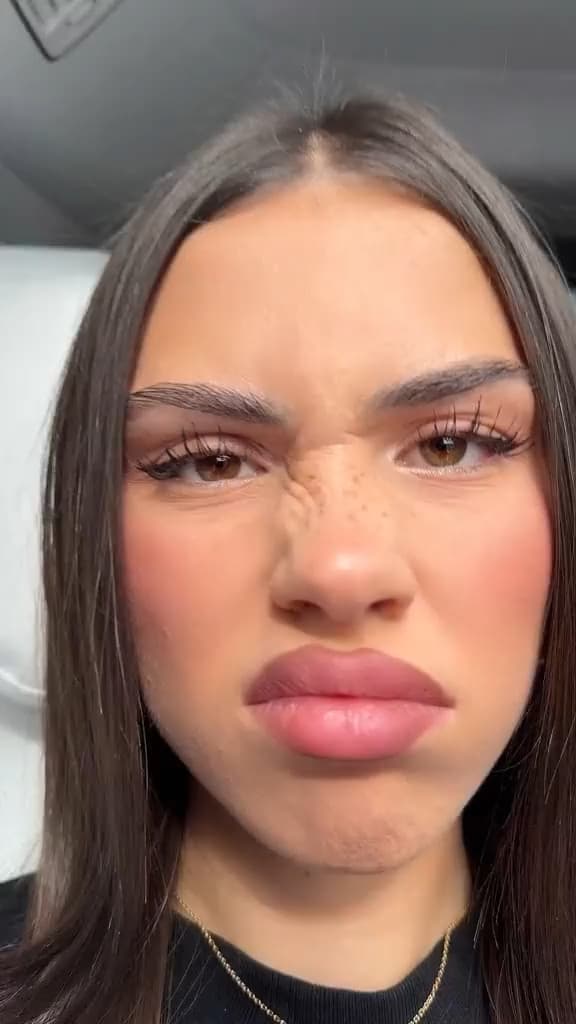 carousel-placeholder